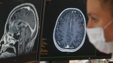 COVID geçse de beyinde iz bırakabiliyor 6 COVID-19’un etkilerinin belirtiler sona erdikten sonra da beyinde devam edebileceğine işaret eden yeni bir araştırma yayımlandı.